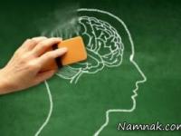 درمان آلزایمر