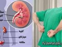 سنگ کلیه