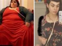 قبل و بعد کاهش وزن