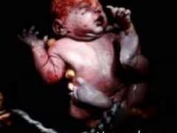 لحظه تولد نوزاد