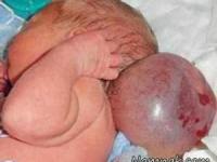 ضایعه جمجمه