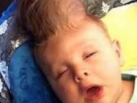 مغز بیرون جمجمه