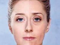 آرایش چشمهای پف آلود