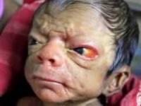 نوزاد 80 ساله