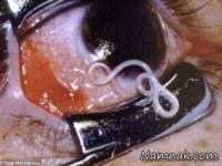 وحشتناکترین بیماری