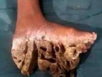 بیماری وحشتناک