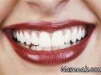 خراب شدن دندان