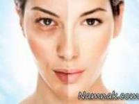 نابود کننده پوست