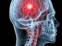 پیر شدن مغز