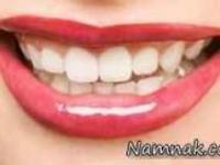 سفيد كردن دندانها