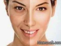 جلوگیری از پیری