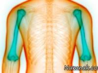 بیماری عجیب