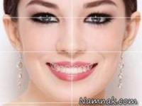 سفید کردن دندان