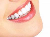 زيبايي دندان