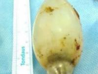 لامپ در شکم