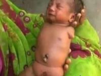 نوزاد بدون دست