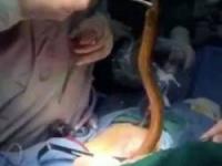 خارج شدن مار از شکم