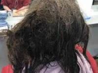 شپش مو