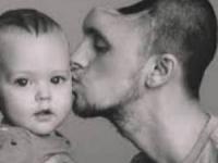 مرد بدون جمجمه