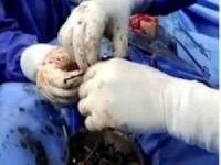 میخ داخل شکم