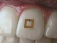 حسگر ضد چاقی