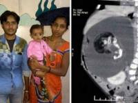 کودک باردار