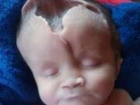 جمجمه نوزاد