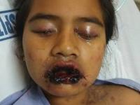 بیماری عجیب پوستی