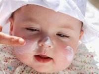 آفتاب سوختگی کودک
