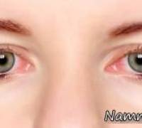 قرمزی چشم
