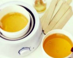 اپیلاسیون ناحیه تناسلی