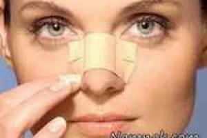 زیبایی بینی