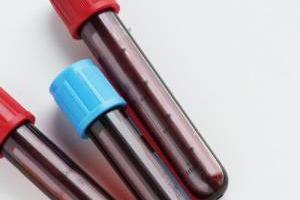 آزمایش قبل بارداری