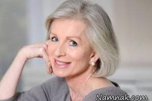 سفید شدن موها