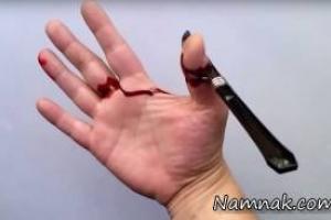 قطع انگشتان