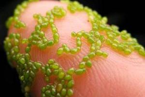 کوچکترین و بزرگترین گل دنیا