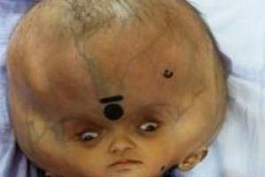 بزرگترین سر دنیا