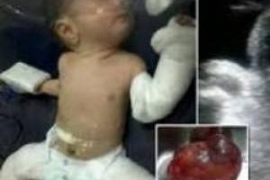 نوزاد باردار