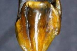 دندان 10 میلیون ساله