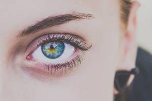 بلفاروپلاستی پلک