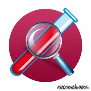 آزمایش ، آزمایش خون fbs