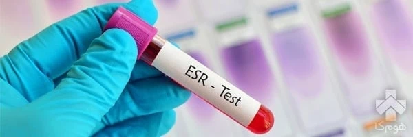 تست خون esr