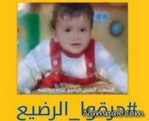 تصاویر دلخراش از نوزاد زنده سوزانده شده