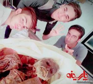 سلفی دانشجویان پزشکی با جسد در سالن تشریح! + تصاویر