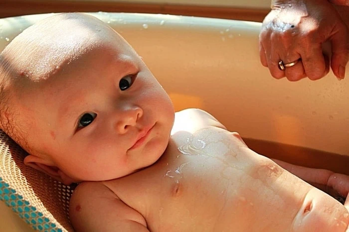 پر مو شدن بدن کودک پرمویی کودک