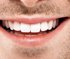 مواد غذایی مضر برای دندان