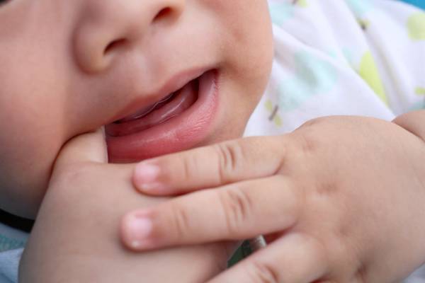 مکیدن انگشت ها