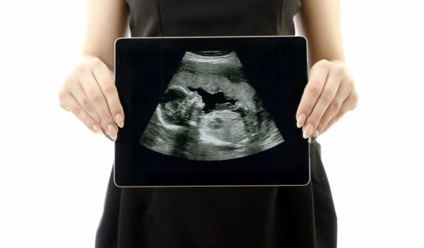 نوزاد در هفته 20 بارداری