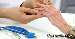 آرتروز روماتوئید