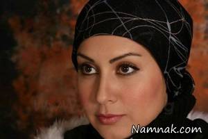 جراحی زیبایی بینی ، عمل بینی